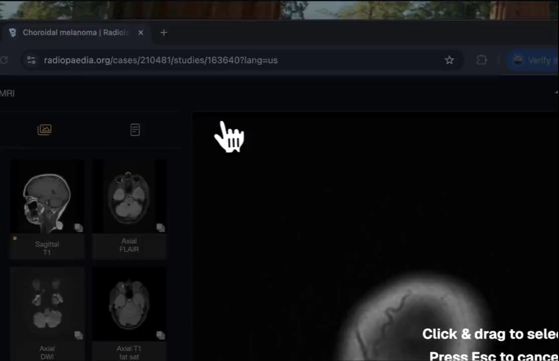 Capture Any Part of Your Screen with Precision demo